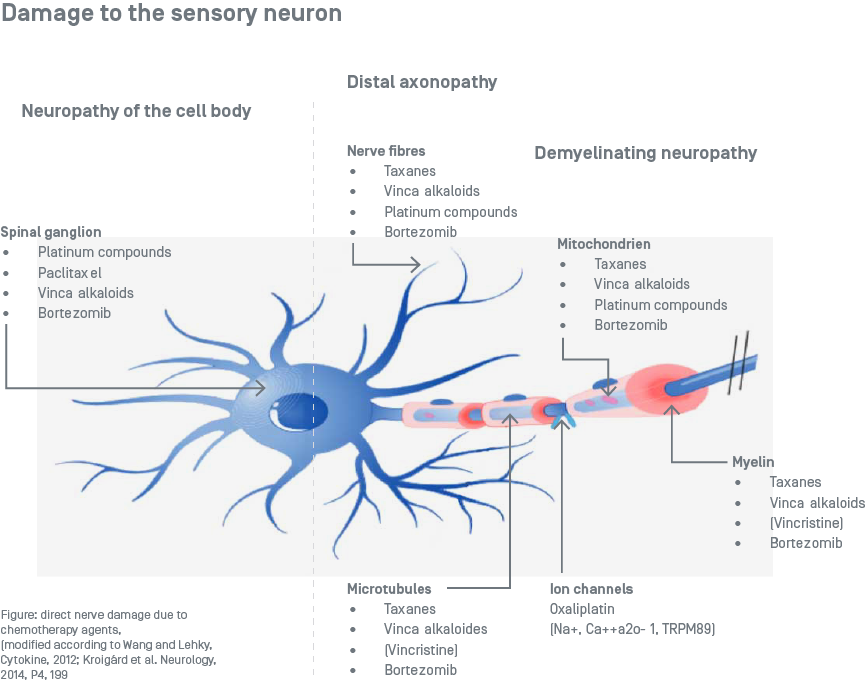 Polyneuropatie - Schäden am Sensorchen Neuron - Grafik